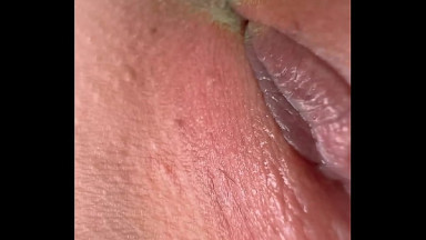 Here's a mystery for you! Why does an 18-year-old girl already have such big nipples?